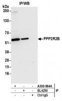 Detection of human PPP2R2B by western bl
