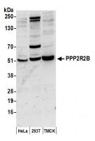 Detection of human and mouse PPP2R2B by