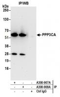 Detection of human PPP3CA by western blo