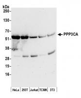 Detection of human and mouse PPP3CA by w