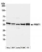 Detection of human and mouse PRMT1 by we