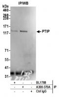 Detection of human PTIP by western blot