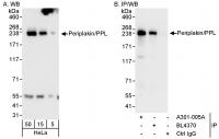 Detection of human Periplakin/PPL by wes