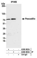 Detection of human Pescadillo by western