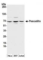 Detection of human Pescadillo by western