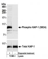Detection of mouse Phospho KAP-1 (S824)