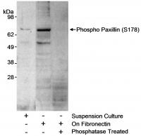 Detection of mouse phospho Paxillin (Ser