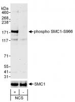 Detection of Phospho SMC1 (S966) by west