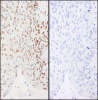 Detection of human Phospho XRCC1 (S461)