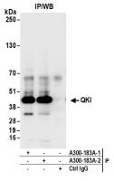 Detection of human QKI by western blot o