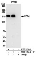 Detection of human RCD8 by western blot