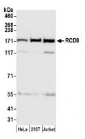 Detection of human RCD8 by western blot.