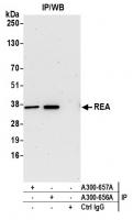 Detection of human REA by western blot o
