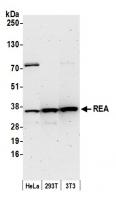 Detection of human and mouse REA by west