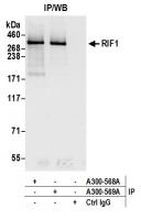 Detection of human RIF1 by western blot