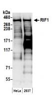 Detection of human RIF1 by western blot.