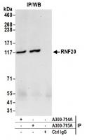 Detection of human RNF20 by western blot