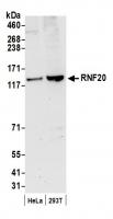 Detection of human RNF20 by western blot
