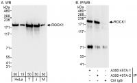 Detection of human and mouse ROCK1 by we
