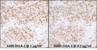 Detection of human RPA70 by immunohistoc