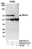 Detection of human RPA70 by western blot