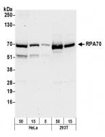 Detection of human RPA70 by western blot