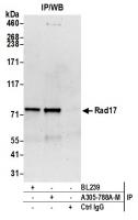 Detection of human Rad17 by western blot