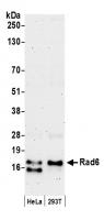 Detection of human Rad6 by western blot.