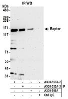 Detection of human Raptor by western blo