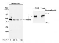 Detection of human RbBP5 by western blot