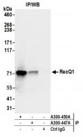 Detection of human RecQ1 by western blot