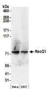 Detection of human RecQ1 by western blot