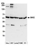 Detection of human and mouse S6K2 by wes