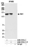 Detection of human SA1 by western blot o