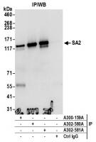 Detection of human SA2 by western blot o