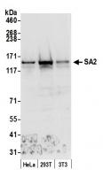 Detection of human and mouse SA2 by west