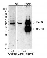 Detection of human SAH3 by western blot