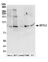 Detection of human and mouse SCYL2 by we