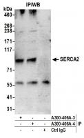 Detection of human SERCA2 by western blo