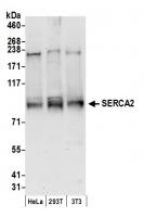Detection of human and mouse SERCA2 by w