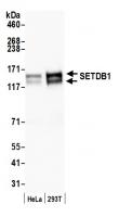 Detection of human SETDB1 by western blo