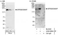 Detection of human SFRS8/SWAP by western