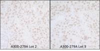 Detection of human SMAR1 by immunohistoc