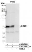 Detection of human SMAR1 by western blot