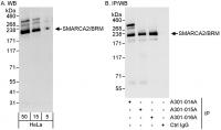 Detection of human SMARCA2/BRM by wester