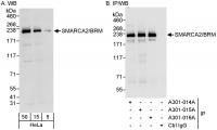 Detection of human SMARCA2/BRM by wester