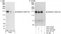 Detection of human SMARCC1/BAF155 by wes