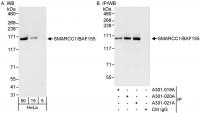 Detection of human SMARCC1/BAF155 by wes