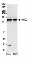 Detection of human SMC2 by western blot.