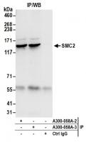 Detection of human SMC2 by western blot